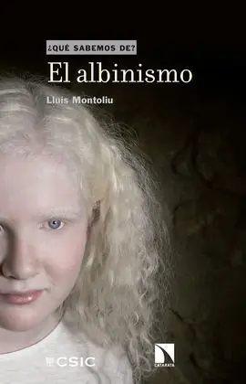 EL ALBINISMO Profesional
